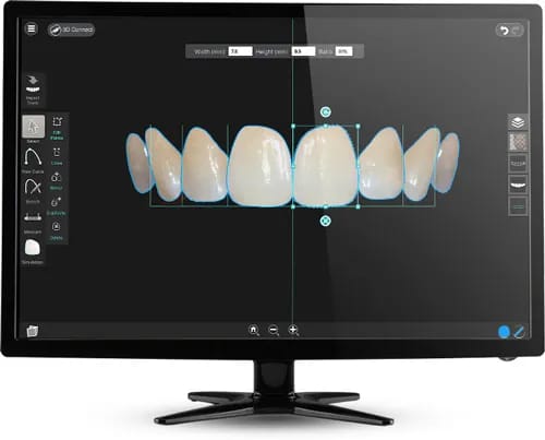 طبيب أسنان يستخدم تقنية تصميم الابتسامة الرقمي (DSD) لتحليل ملامح وجه المراجع.
